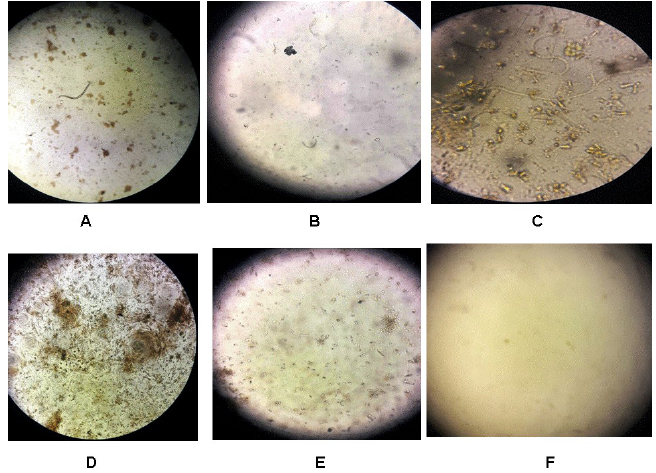 Desarrollo de biopel&iacute;culas en la cuarta
semana de incubaci&oacute;n. A) con filtro azul, B) con filtro verde, C) con filtro amarillo, D) con filtro rojo, E) sin
filtro (control 1), y F) envuelto en tela oscura (control 2). Todas las fotos a
un aumento de 400x (objetivo 40x y ocular a 10x).