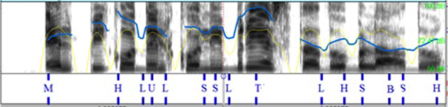 Segmentaci&oacute;n en fonemas.