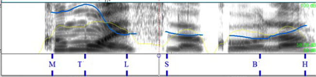 Comparaci&oacute;n de la pronunciaci&oacute;n espa&ntilde;ola
por hablantes italianos 

en la query_w encabezadas por un pronombre
interrogativo.