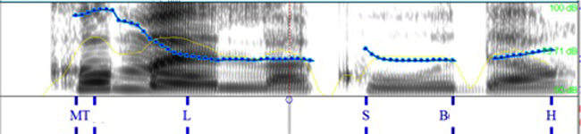 query_w
en italiano; &iquest;c&oacute;mo es la cola?