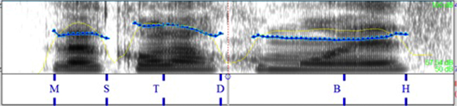 Comparaci&oacute;n de la pronunciaci&oacute;n espa&ntilde;ola
por hablantes italianos 

en la query_w, no encabezadas por un
interrogativo.
