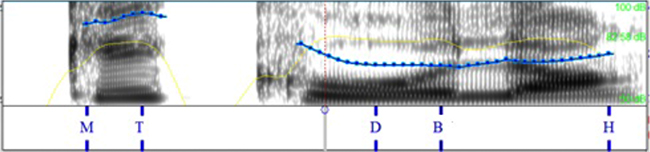 Comparaci&oacute;n de la pronunciaci&oacute;n
espa&ntilde;ola por hablantes italianos en la hold. 

 