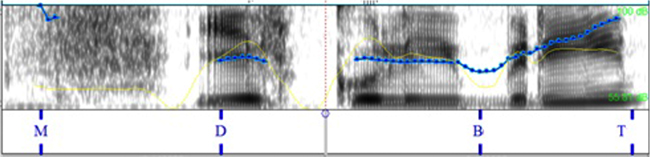 Comparaci&oacute;n de la pronunciaci&oacute;n
espa&ntilde;ola por hablantes italianos en la info_request.