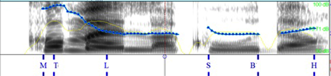 query_w
en italiano; &iquest;C&oacute;mo es la cola?