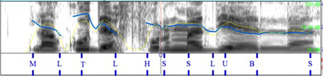 Resultado de la transposici&oacute;n
pros&oacute;dica. Q_w &iquest;c&oacute;mo es la cola?