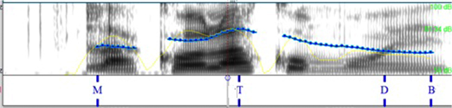 Comparaci&oacute;n de la pronunciaci&oacute;n
espa&ntilde;ola por hablantes italianos en la query_w,
no encabezadas por un interrogativo.