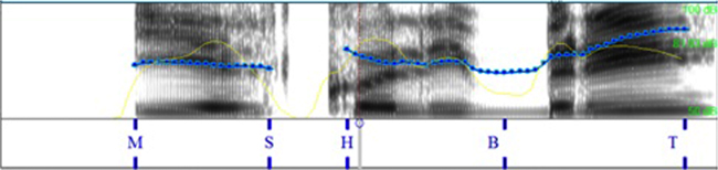 Comparaci&oacute;n de la pronunciaci&oacute;n
espa&ntilde;ola por hablantes italianos en la info_request.