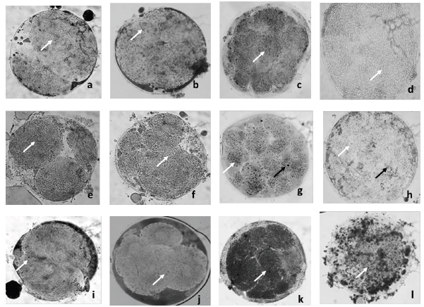 ACCUMULATION OF CYTOPLASMIC LIPID DROPLETS
IN BOVINE EMBRYOS CULTIRED IN PVA (a, b, c and d), BSA (e, f, g and h) AND
BSA+FCS 2.5% (I, j, k and l) AFTER STAINING WITH SUDAN BLACK B (400X). WHITE
ARROWS INDICATE SMALL SUDANOPHILIC LIPID DROPLETS. BLACK ARROWS INDICATE MEDIUM
SUDANOPHILIC LIPID DROPLETS. WHITE ARROWHEADS INDICATE LARGE SUDANOPHILIC LIPID
DROPLETS. LETTERS a, e AND i: 2 CELL EMBRYOS; b, f AND j: >4 CELL EMBRYOS;
c, g AND k: MORULAE; d, h AND l: BLASTOCYSTS.