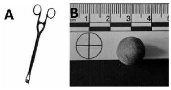 A F�rceps para retiro de balas esf�ricas de plomo Colecci�n privada B Bala esf�rica de plomo utilizada en fusiles europeos de la primera mitad del siglo XIX Colecci�n privada del Instituto de Estudios Hist�ricos del Pac�fico Lima Per�