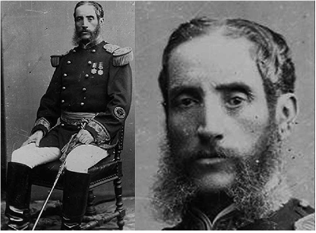 Andr�s A. C�ceres, Estudio Courret 1885. Se observa retracci�n del canto medial izquierdo hacia abajo, ectropi�n cicatrizal, leve hundimiento del surco palpebral superior, hipoglobo por posible fractura de piso orbitario. La retracci�n del p�rpado inferior ha mejorado en relaci�n a las fotograf�as de una d�cada atr�s.